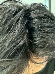 -熙朵美学植发·连锁品牌