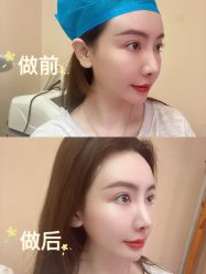 点击看大图 -深圳美莱医疗美容医院