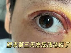 -丰联丽格医疗美容·联合丽格眼整形中心