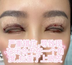 -天津伊美尔医疗整形美容专科医院