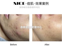 -唯奈斯肌肤管理中心