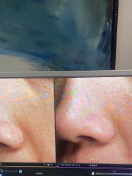 -苑苑vbeauty科技美容SPA