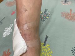 -成都市第一人民医院(南区)