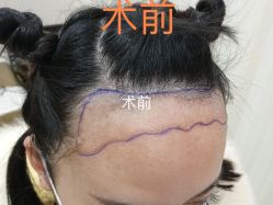 -郡艺医疗美容·微整·眼鼻吸脂
