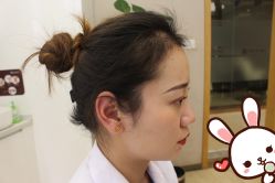 -大麦微针植发丨全国连锁