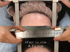 -FACE·日本小颜美容整骨(福田店)