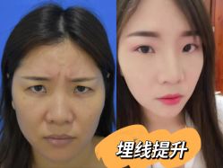 -天津健丽·去眼袋医疗美容机构