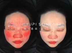 点击看大图 -MLP美丽派·问题肌疗愈中心