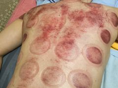 -沈师傅盲人按摩工作室(密三小区店)