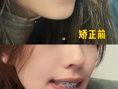 -极光口腔·矫正种植修复(锦江店)