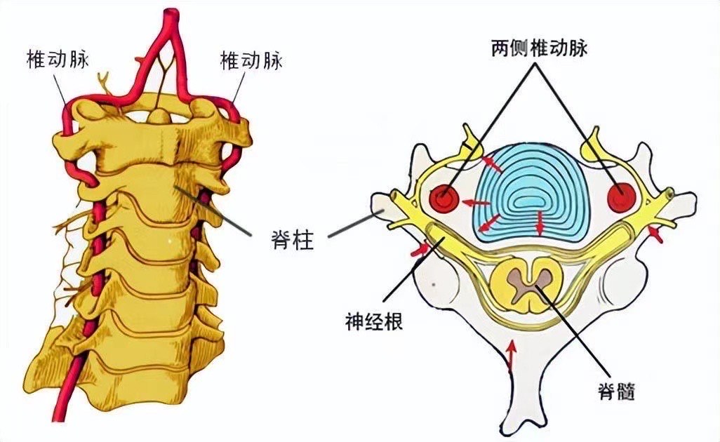 头后大直肌疼痛图片