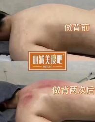-丽减美瘦吧·减肥瘦身