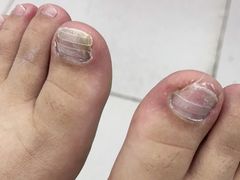 -新甲连锁灰指甲·甲沟炎·鸡眼(黑龙江路店)