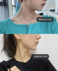 -温州伯思立医院