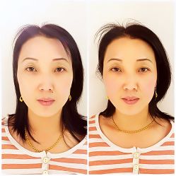 -FACE·日本小颜美容整骨