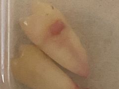 -爱贝口腔·牙周诊疗·种植修复中心