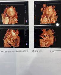 -济南艾玛妇产医院