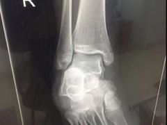 -成都市第一人民医院(南区)