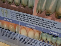 -圣呗口腔·舒适化种植牙·矫正中心(广州总院)