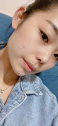-北京美痣堂古方祛痣斑疣瘊