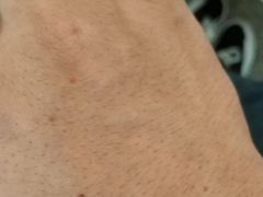 -上海中医药大学附属曙光医院(东部)