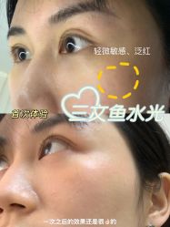 -小忠丽格医美