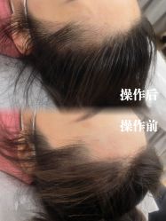 -西施无菌半永久纹绣眉眼影唇轻增发纹发际线
