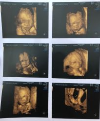 -杭州贝瑞斯美华妇儿医院·早孕·产检·儿科