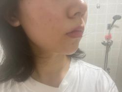 体验后-重庆军科整形美容医院