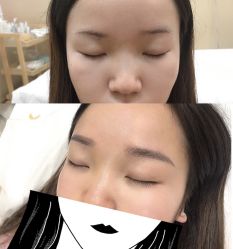 点击看大图 -瑾秀美肤·问题肌修护
