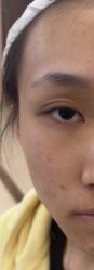 -长沙雅美医疗美容医院