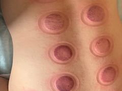 -顺则昌推按正骨理疗