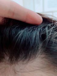 -熙朵美学植发·连锁品牌