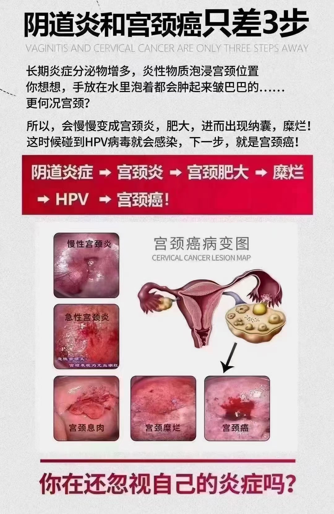 女人没有子宫能活多久图片