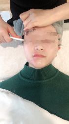 -溢美古法抗衰