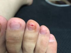 -郑远元专业修脚房(昌里东路店)