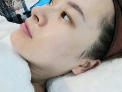 点击看大图 -痘院长·祛痘·皮肤管理