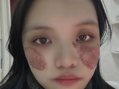 -重庆医科大学附属第一医院(本部)