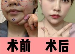 -上海漾颜医疗美容