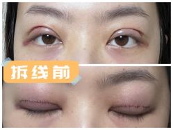 -素美医疗美容·西南眼鼻整形·修复基地