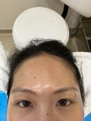 -嘉和医学脱毛中心