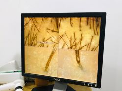 -章光101防脱养发荟