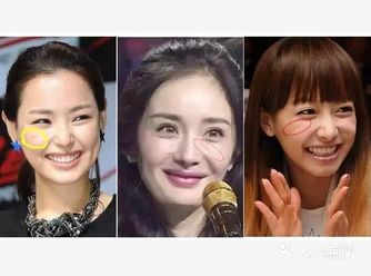 什么是印第安纹脸上出现印第安纹