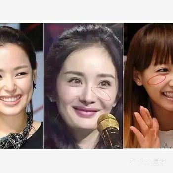 什么是印第安纹脸上出现印第安纹