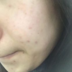 体验前-北京米扬丽格医疗美容·联合丽格鼻整形中心