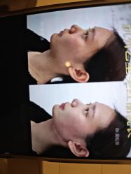 -Yestar杭州艺星医疗美容医院