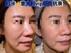 -安吉拉青春化管理中心