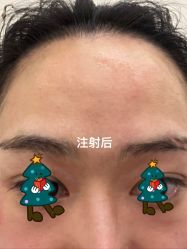 -BR光电保养