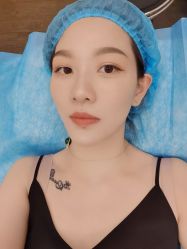 体验前-上海玫瑰医疗美容医院