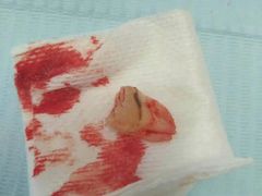 -爱贝口腔·牙周诊疗·种植修复中心